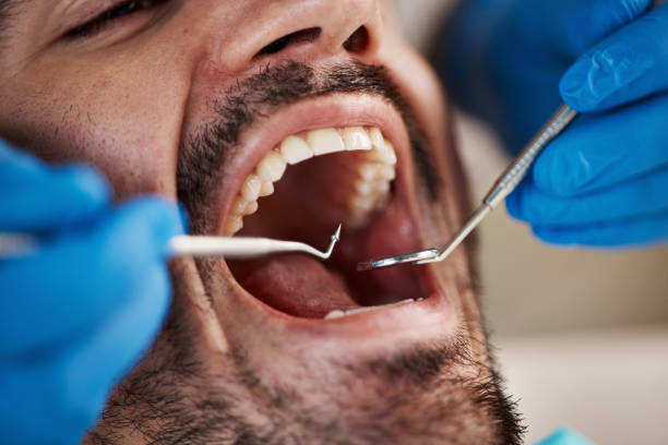 Best Emergency Tooth Extraction  in Fort Totten, ND